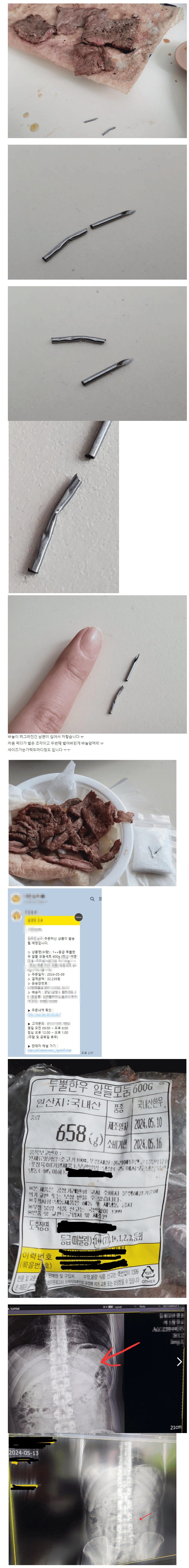 소고기 먹다가 주사바늘 삼켜버린 남편 ㄷㄷㄷ