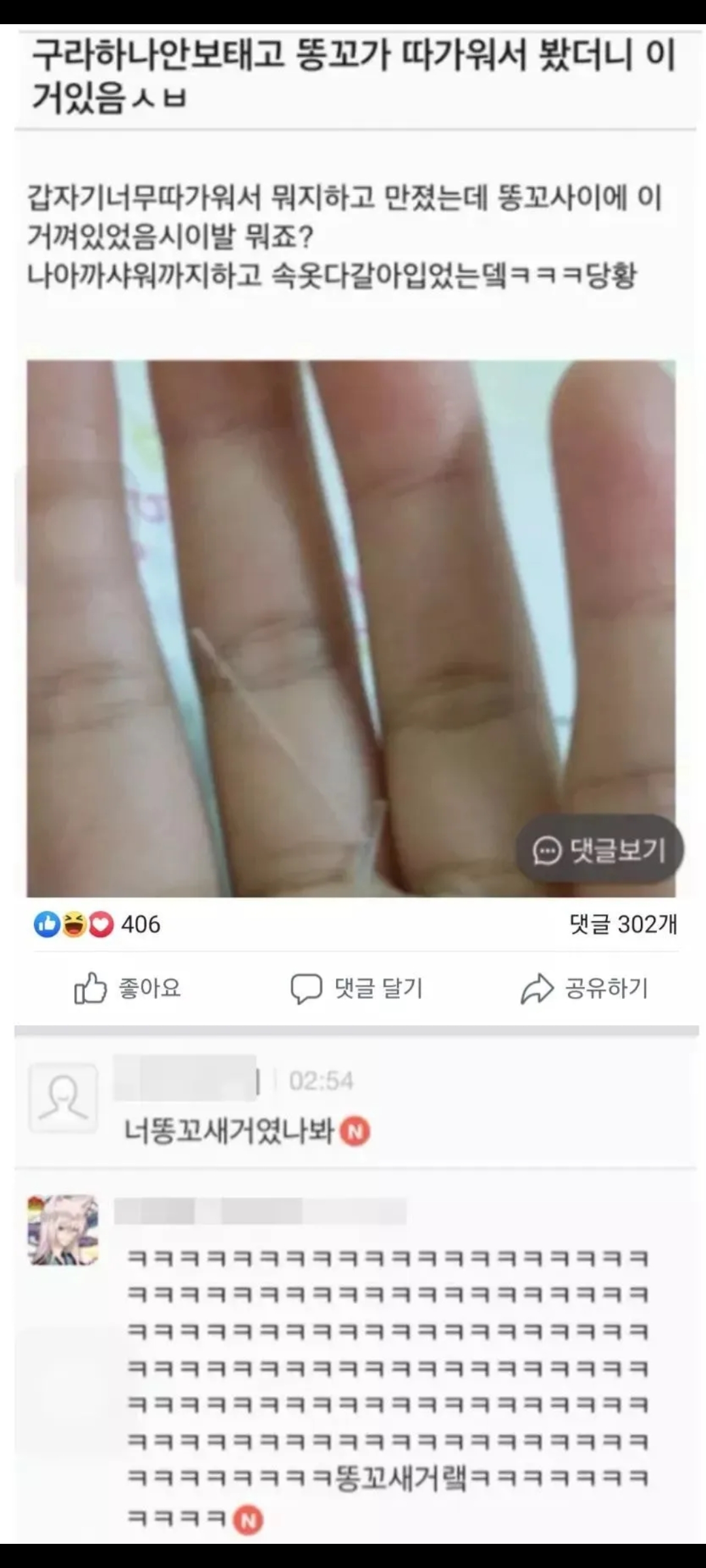 똥꼬가 따가우서